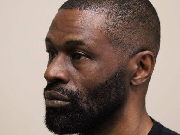 Rhinoplasty Patient 48 Before 2