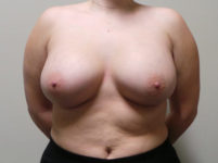 After Image