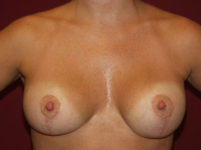 After Image