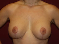 After Image