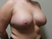 After Image