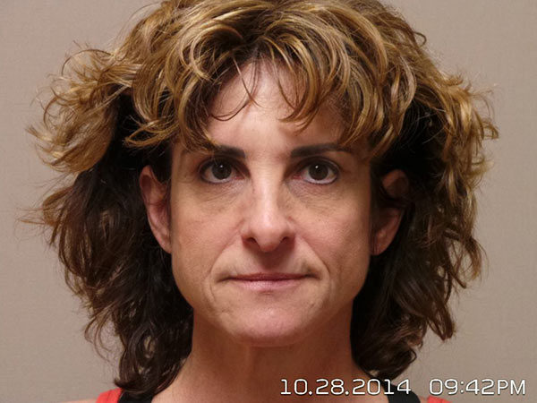 Facelift Patient 09 Before 1