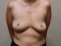 After Image