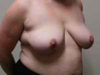 After Image