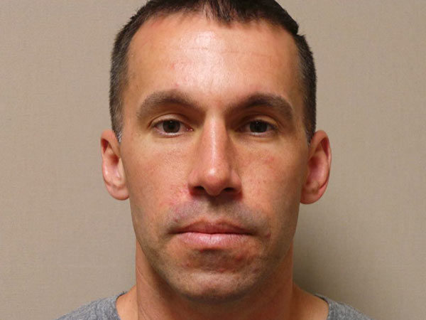 Rhinoplasty Patient 02 After 1