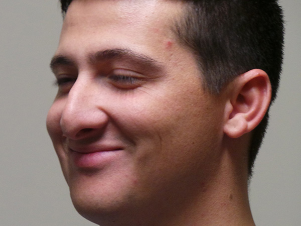 Rhinoplasty Patient 49 Before 2